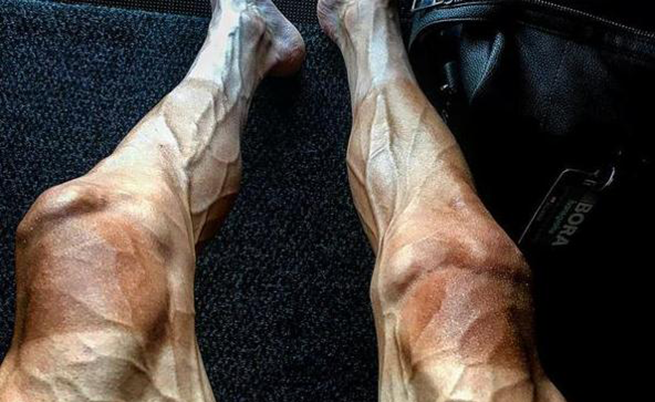 A foto de Pawel Poljanski após o Tour de France: o que aconteceu com suas pernas?
