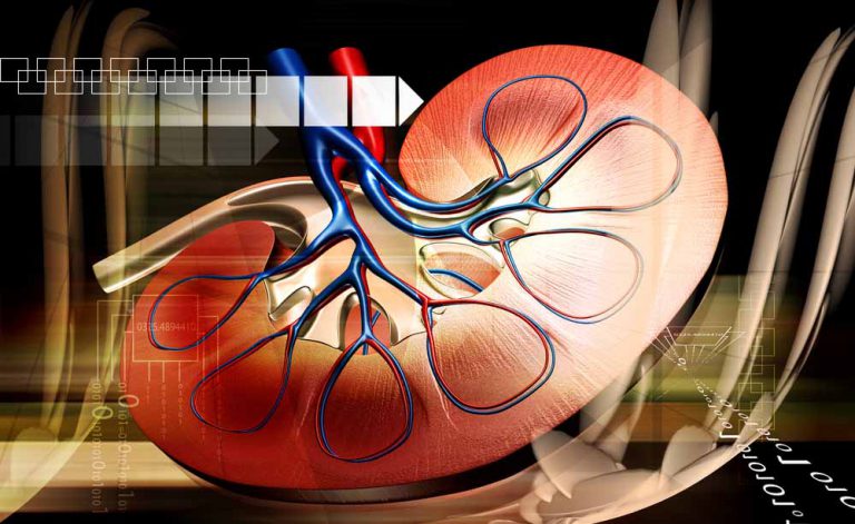 Hipertensão: e se a causa foram os rins?