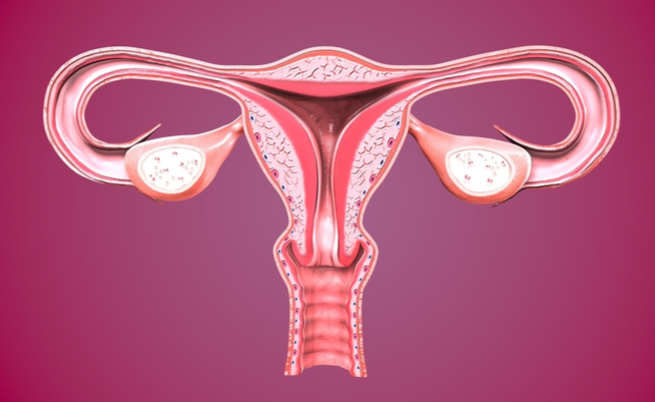 Mioma do útero, que é o mais em risco?