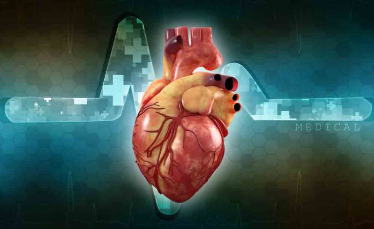 Sopro cardíaco: é possível curálo?